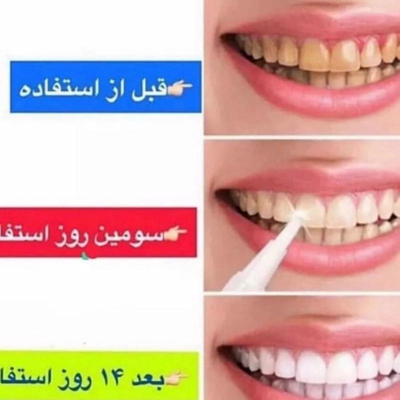 پودر سفید کننده دندان