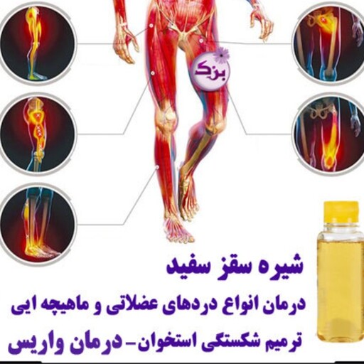 شیره سقز کوهی تلخ خالص درخت پسته کوهی  ون یا بنه