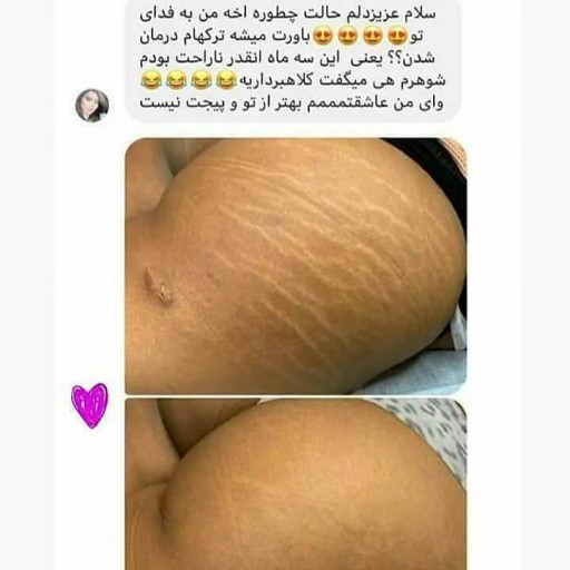 پکیج رفع تیرگی و چین و چروک صورت و بدن