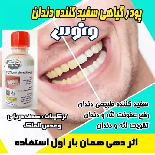 پودر گیاهی سفید کننده دندان ونوس