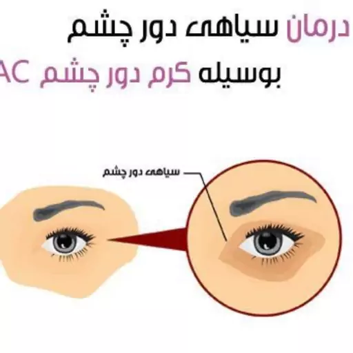 کرم دور چشم لیراک ضد چین و چروک و شفاف کننده پوست زیر چشم