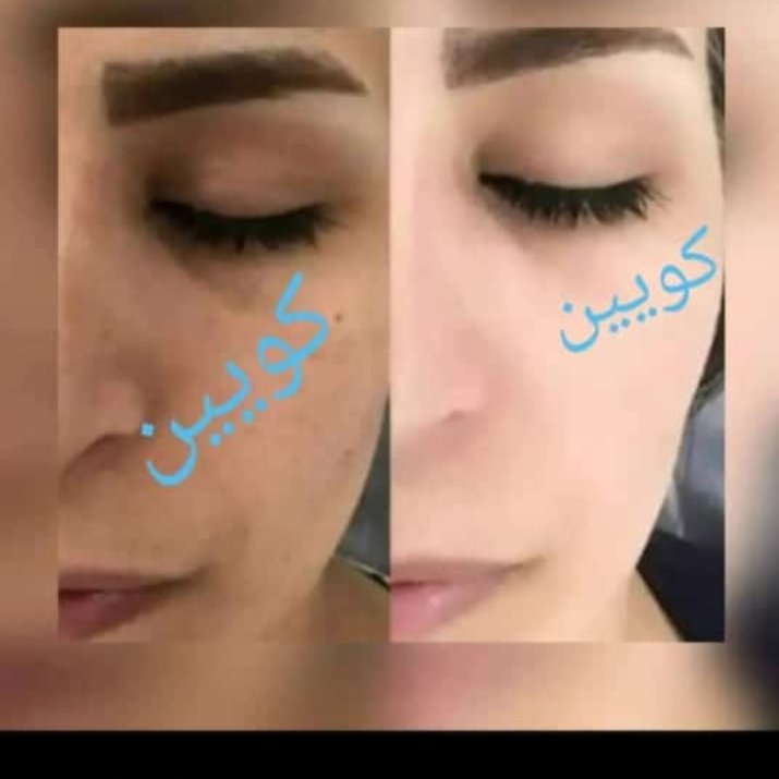  کرم شب کویین