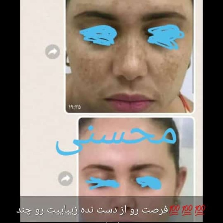  کرم شب کویین