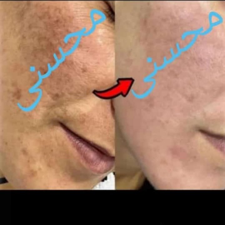  کرم شب کویین