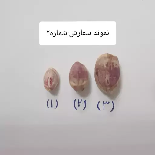 مغز پسته درجه 1 ترد و تازه(یک کیلویی).ارسال رایگان