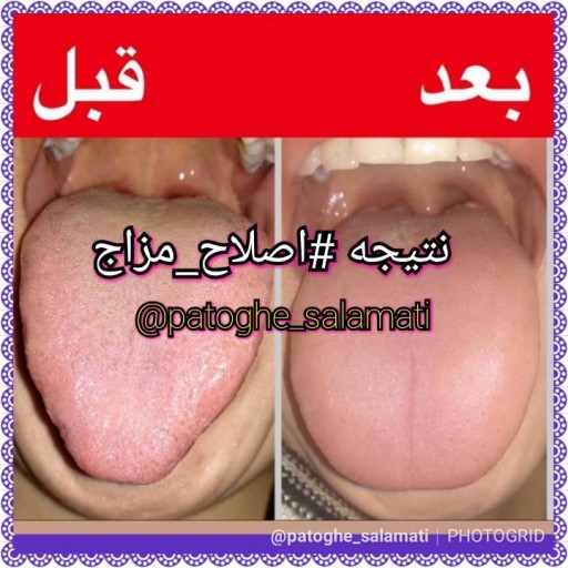 اکسیر پاکسازی خون وکبد (ادویه کیلوس) - باسلام